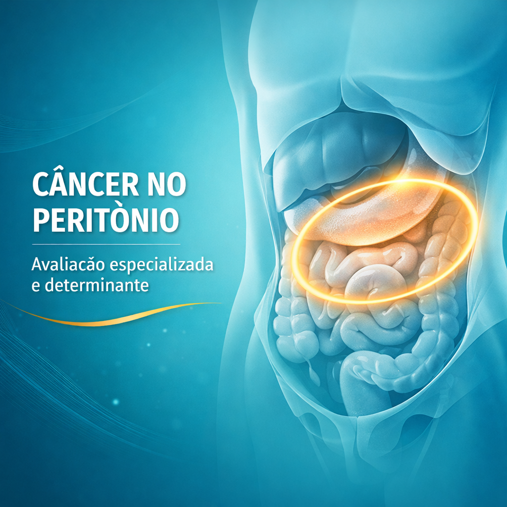 Ilustração médica representando o peritônio e câncer no peritônio em estilo moderno e minimalista, destacando a importância da avaliação especializada.